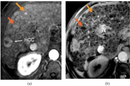 https://cdn.ncbi.nlm.nih.gov/pmc/blobs/8905/2582507/eb03ed3dc775/ci08901901.jpg