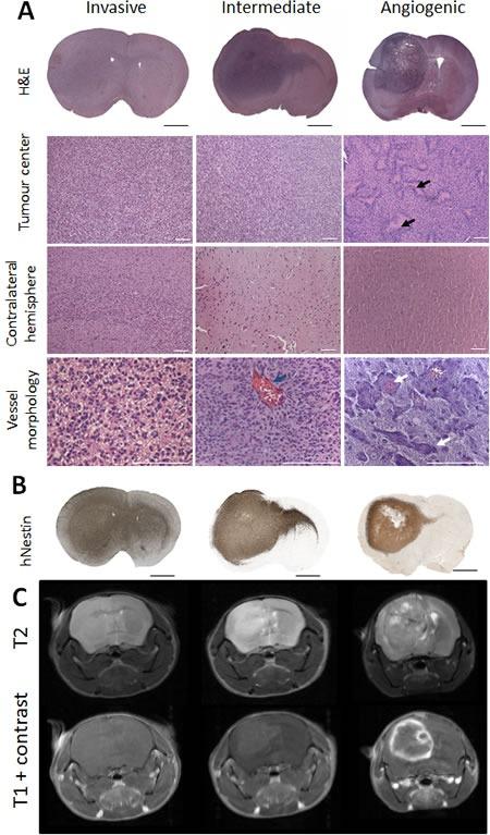 https://cdn.ncbi.nlm.nih.gov/pmc/blobs/8906/5077988/99e74d52707a/oncotarget-07-31955-g001.jpg