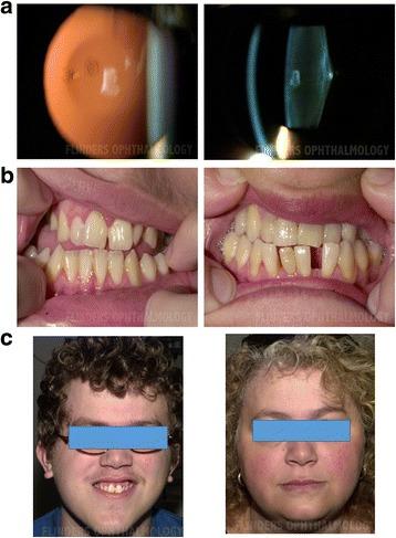 https://cdn.ncbi.nlm.nih.gov/pmc/blobs/8914/5422868/1a1383994a22/12881_2017_414_Fig2_HTML.jpg