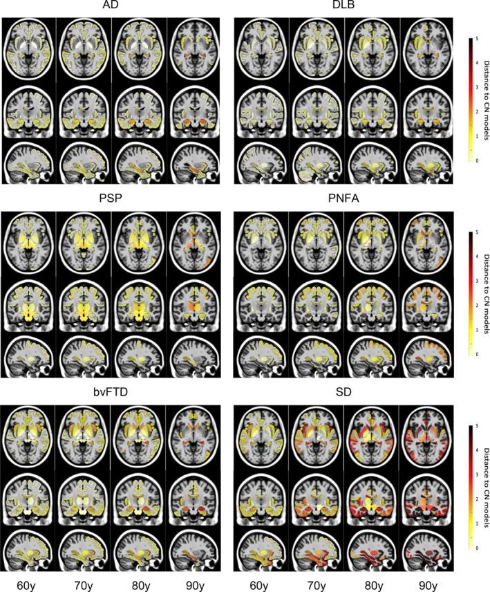 https://cdn.ncbi.nlm.nih.gov/pmc/blobs/8919/12400355/feb26c39f2f7/HBM-46-e70336-g002.jpg