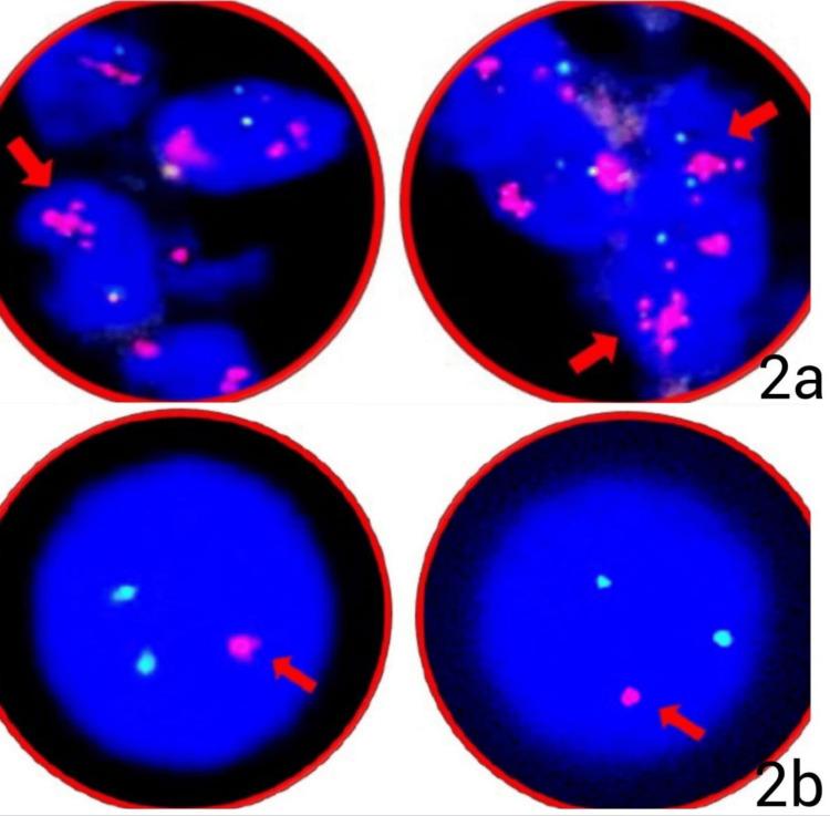 https://cdn.ncbi.nlm.nih.gov/pmc/blobs/891a/12179749/d295f8438ed9/cureus-0017-00000084522-i02.jpg