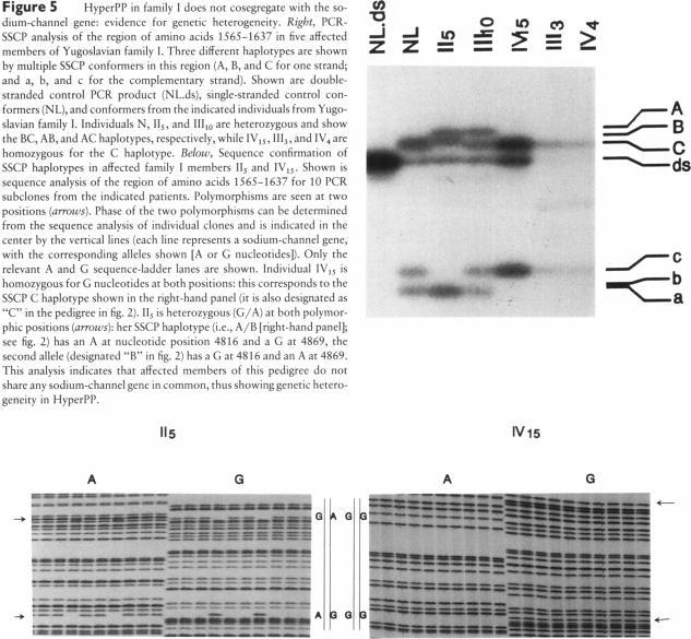 https://cdn.ncbi.nlm.nih.gov/pmc/blobs/891b/1682261/573846571172/ajhg00064-0063-a.jpg