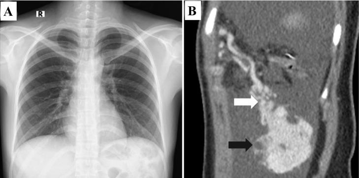 https://cdn.ncbi.nlm.nih.gov/pmc/blobs/891c/8861309/5bfde0a51f00/gr2.jpg