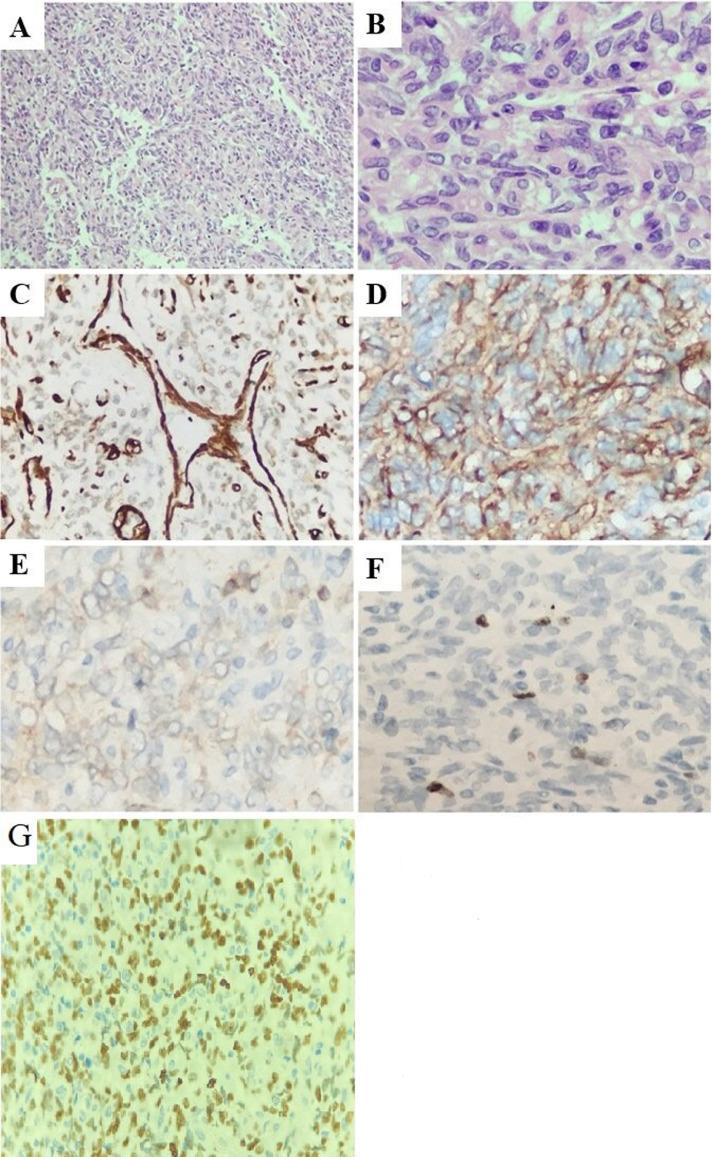 https://cdn.ncbi.nlm.nih.gov/pmc/blobs/891c/8861309/b2cb2f62647f/gr3.jpg