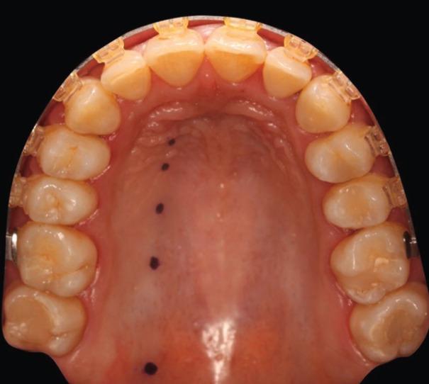 https://cdn.ncbi.nlm.nih.gov/pmc/blobs/891d/9328489/318420c1e933/jced-14-e528-g004.jpg