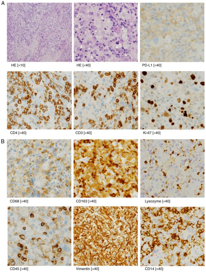 https://cdn.ncbi.nlm.nih.gov/pmc/blobs/8920/9353867/a4182e13ec9d/mco-17-03-02569-g00.jpg