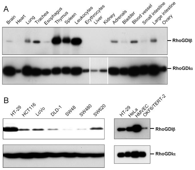 https://cdn.ncbi.nlm.nih.gov/pmc/blobs/892e/3583720/d95c704b5ff3/IJO-42-02-0460-g00.jpg