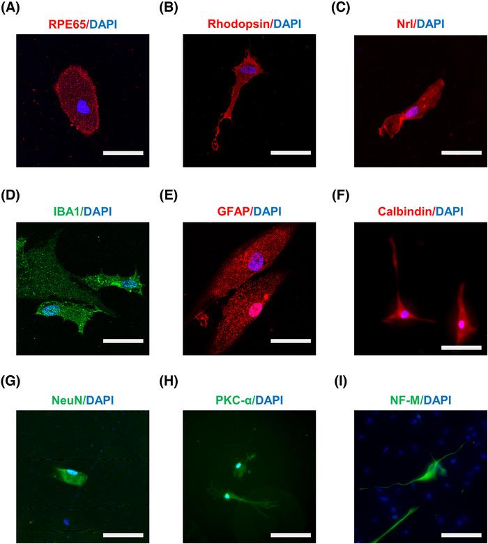 https://cdn.ncbi.nlm.nih.gov/pmc/blobs/892f/9790047/89957a0a3b32/MCO2-4-e198-g003.jpg