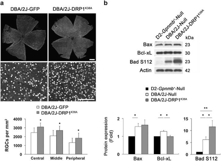 https://cdn.ncbi.nlm.nih.gov/pmc/blobs/8938/4558491/7c89e813337b/cddis2015180f6.jpg