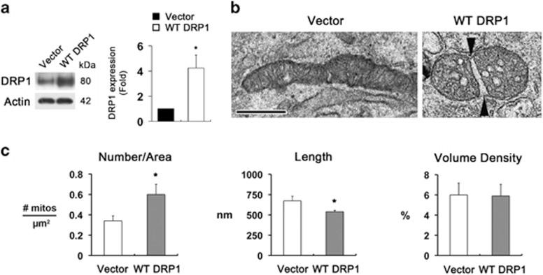 https://cdn.ncbi.nlm.nih.gov/pmc/blobs/8938/4558491/f2f517c7d81f/cddis2015180f4.jpg