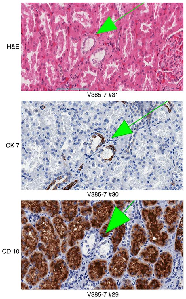 https://cdn.ncbi.nlm.nih.gov/pmc/blobs/8938/9647499/383a1bff27cc/or-48-06-08437-g03.jpg