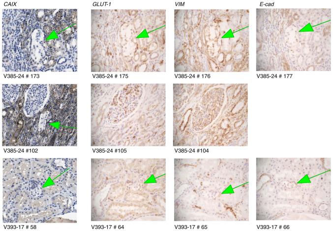 https://cdn.ncbi.nlm.nih.gov/pmc/blobs/8938/9647499/aa9005fdba7a/or-48-06-08437-g02.jpg