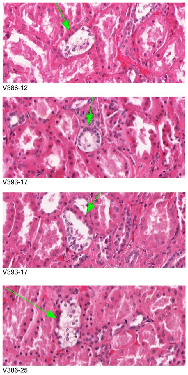 https://cdn.ncbi.nlm.nih.gov/pmc/blobs/8938/9647499/c7e7001ffec2/or-48-06-08437-g00.jpg