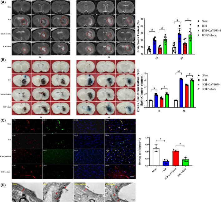 https://cdn.ncbi.nlm.nih.gov/pmc/blobs/893f/8111497/781b96a24b07/CNS-27-674-g003.jpg