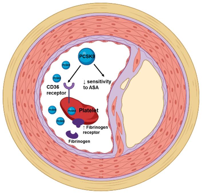 https://cdn.ncbi.nlm.nih.gov/pmc/blobs/893f/9267174/1a89fea4de06/jcm-11-03625-g002.jpg
