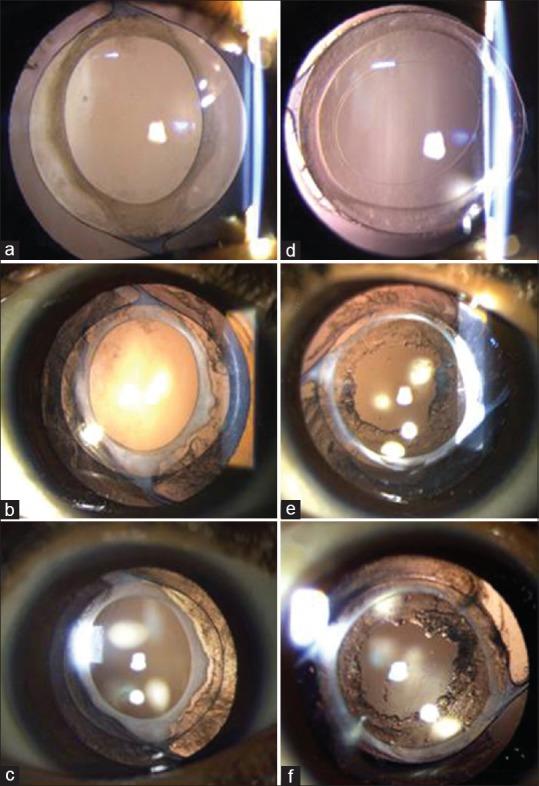 https://cdn.ncbi.nlm.nih.gov/pmc/blobs/8941/6951169/ef18f84d4613/IJO-68-84-g001.jpg