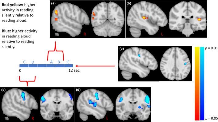 https://cdn.ncbi.nlm.nih.gov/pmc/blobs/894a/8035434/256a6fd52ff3/BRB3-11-e02042-g003.jpg