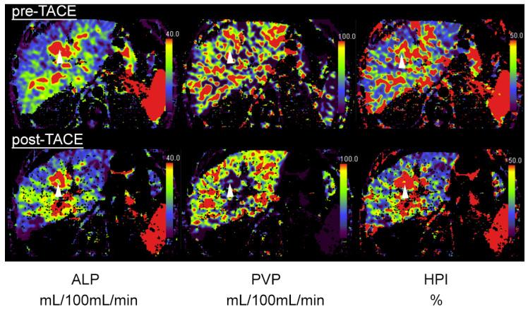 https://cdn.ncbi.nlm.nih.gov/pmc/blobs/894c/9028792/0ccb14988dfe/tomography-08-00094-g002.jpg