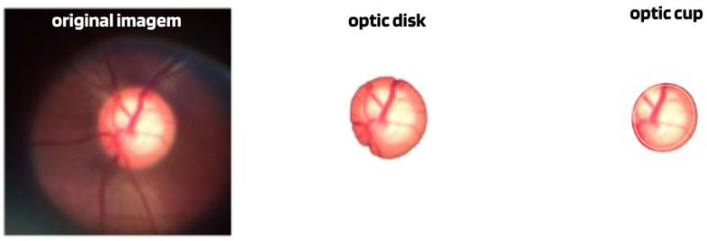 https://cdn.ncbi.nlm.nih.gov/pmc/blobs/894d/10930993/3f61850bcdfe/diagnostics-14-00530-g004.jpg