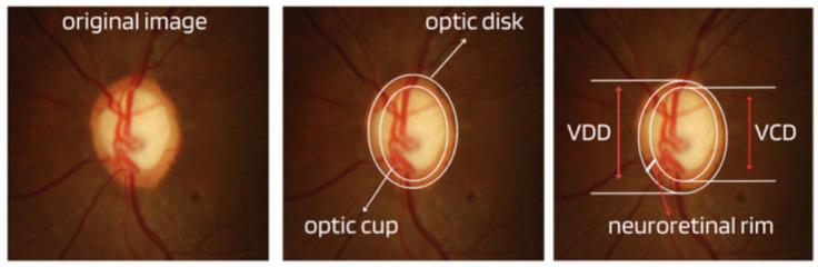 https://cdn.ncbi.nlm.nih.gov/pmc/blobs/894d/10930993/4cf950b5f940/diagnostics-14-00530-g002.jpg