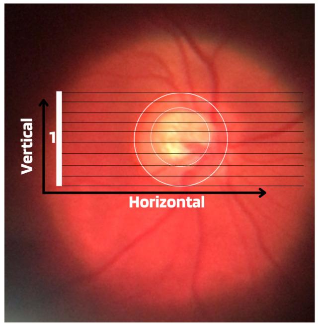 https://cdn.ncbi.nlm.nih.gov/pmc/blobs/894d/10930993/ff15948311cb/diagnostics-14-00530-g003.jpg