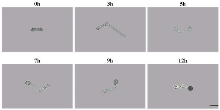 https://cdn.ncbi.nlm.nih.gov/pmc/blobs/8951/10138971/56aeb69af725/ijms-24-07411-g001.jpg