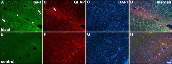 https://cdn.ncbi.nlm.nih.gov/pmc/blobs/8953/3893550/3b2f1eb6af50/2051-5960-1-51-4.jpg