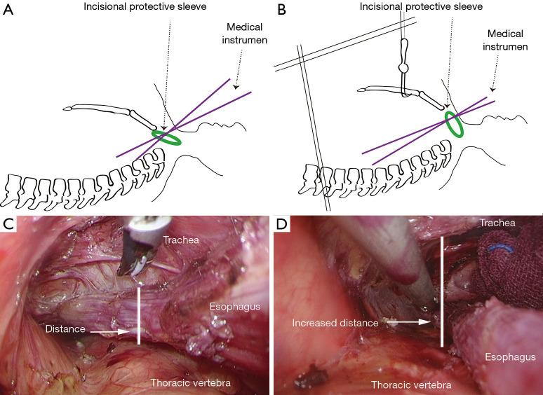 https://cdn.ncbi.nlm.nih.gov/pmc/blobs/8953/8482327/70fa3408de88/jtd-13-09-5546-f3.jpg