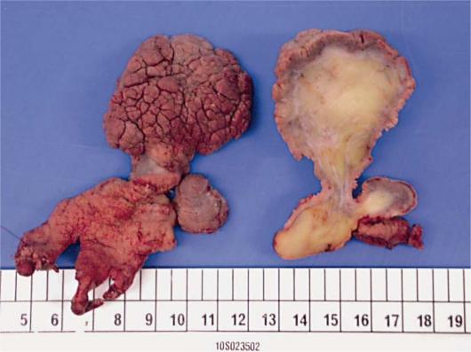 https://cdn.ncbi.nlm.nih.gov/pmc/blobs/8958/3088745/3648d20b0871/crg0005-0183-f03.jpg