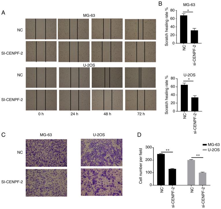 https://cdn.ncbi.nlm.nih.gov/pmc/blobs/895a/8652394/d385a057bd27/etm-23-01-11003-g07.jpg
