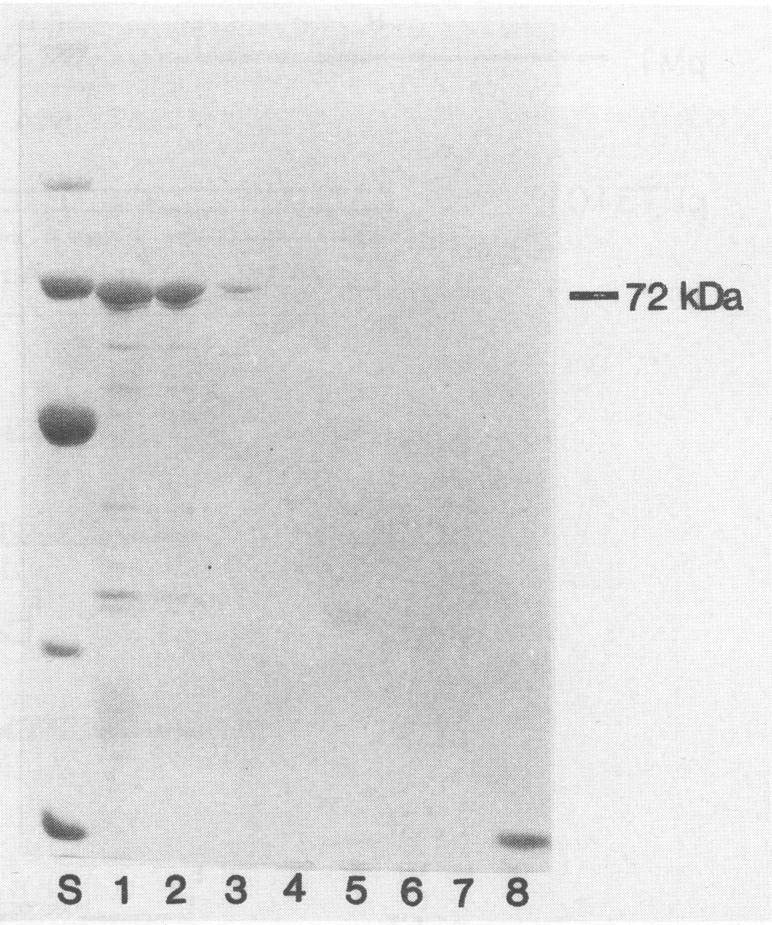 https://cdn.ncbi.nlm.nih.gov/pmc/blobs/8961/202194/92db926c7b0c/aem00032-0172-a.jpg