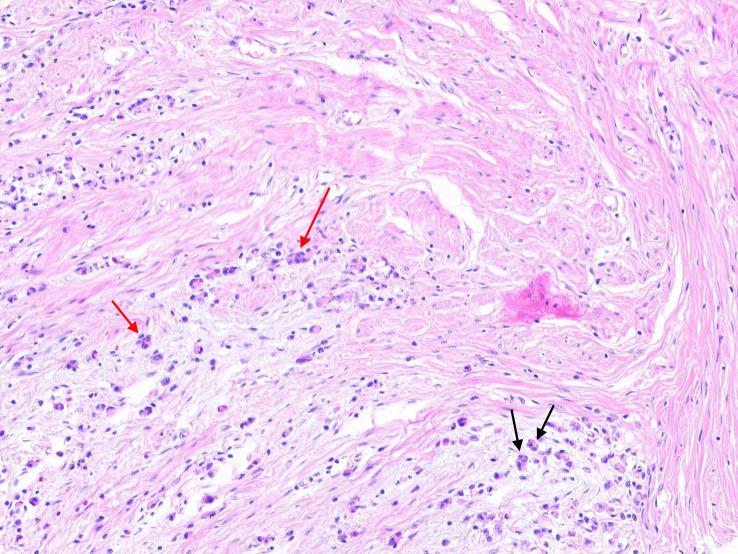 https://cdn.ncbi.nlm.nih.gov/pmc/blobs/8961/9900096/f1256157f132/fonc-12-1003959-g001.jpg