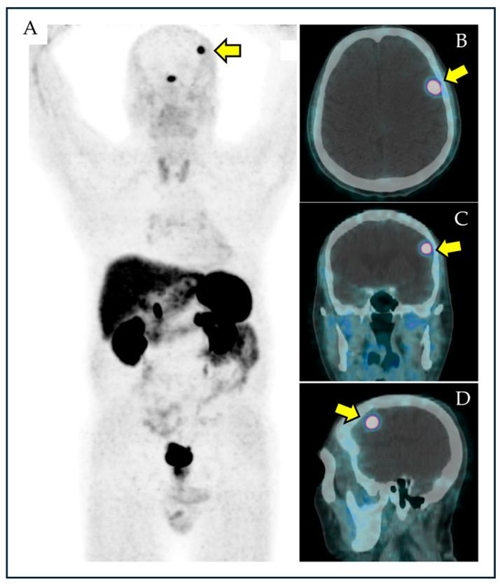 https://cdn.ncbi.nlm.nih.gov/pmc/blobs/8966/12110180/83085776ae49/diagnostics-15-01204-g001.jpg