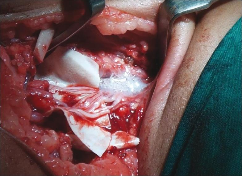 https://cdn.ncbi.nlm.nih.gov/pmc/blobs/8966/3263264/70cf1c661383/IJPS-44-380-g007.jpg