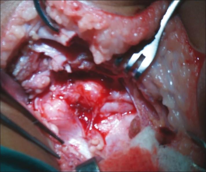 https://cdn.ncbi.nlm.nih.gov/pmc/blobs/8966/3263264/a012f3be67ea/IJPS-44-380-g002.jpg