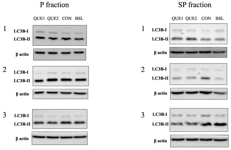 https://cdn.ncbi.nlm.nih.gov/pmc/blobs/896d/11678826/b0134a9b590b/nutrients-16-04282-g004a.jpg