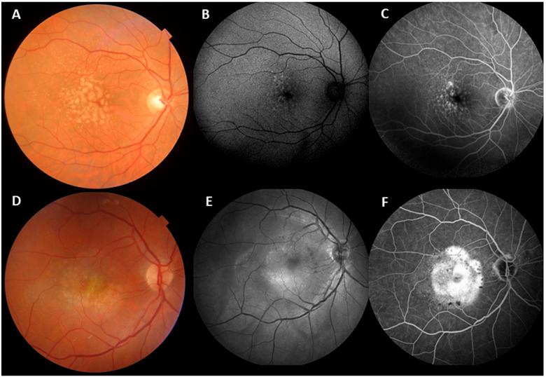 https://cdn.ncbi.nlm.nih.gov/pmc/blobs/8970/10783600/9c4ca22ff759/assn-46-03-e1052-g2.jpg