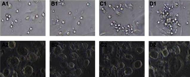 https://cdn.ncbi.nlm.nih.gov/pmc/blobs/8970/3649858/1a859f991ca5/ott-6-503Fig2.jpg