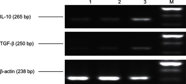 https://cdn.ncbi.nlm.nih.gov/pmc/blobs/8970/3649858/2c312855528f/ott-6-503Fig1.jpg