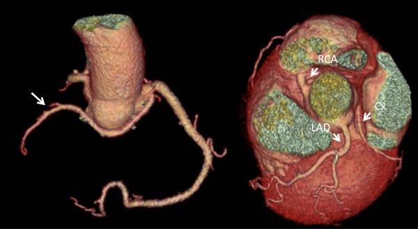 https://cdn.ncbi.nlm.nih.gov/pmc/blobs/8972/4118645/890c7f7b742f/1471-2261-14-81-2.jpg