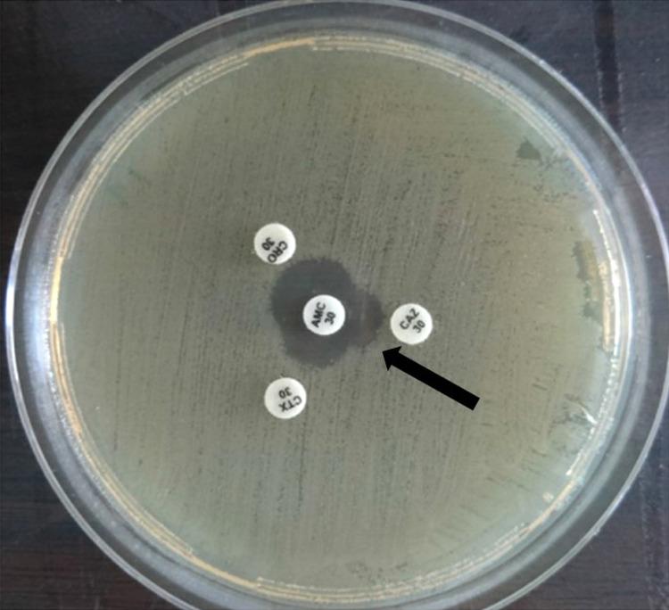https://cdn.ncbi.nlm.nih.gov/pmc/blobs/897c/10476660/5d352e04ee7a/IJGM-16-3963-g0002.jpg