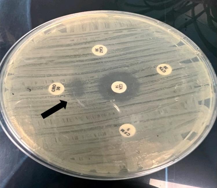 https://cdn.ncbi.nlm.nih.gov/pmc/blobs/897c/10476660/71245c1cffda/IJGM-16-3963-g0003.jpg