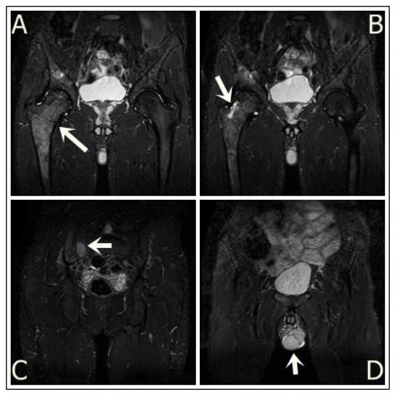 https://cdn.ncbi.nlm.nih.gov/pmc/blobs/897d/5111499/08dc156d3e87/cm-89-559f4.jpg