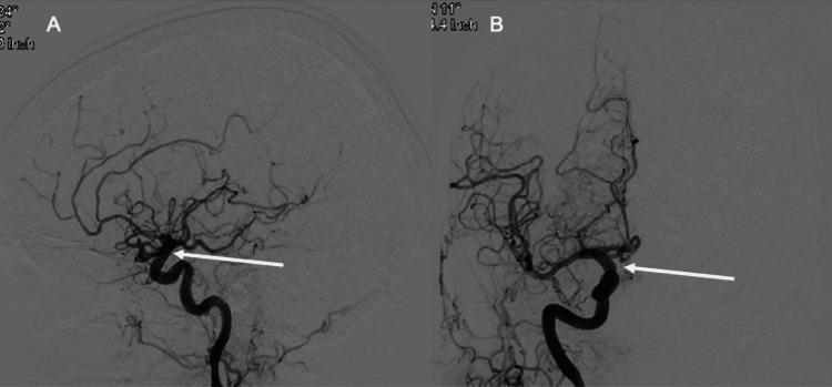 https://cdn.ncbi.nlm.nih.gov/pmc/blobs/897e/9245062/4aee13d3f0a5/cureus-0014-00000025516-i03.jpg