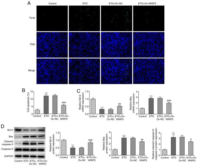 https://cdn.ncbi.nlm.nih.gov/pmc/blobs/8985/8453325/0937ae30d887/etm-22-05-10689-g03.jpg