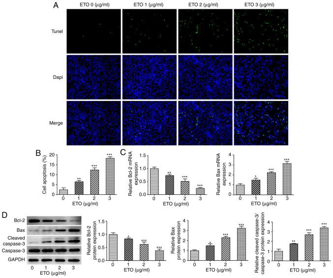 https://cdn.ncbi.nlm.nih.gov/pmc/blobs/8985/8453325/14c86c71a3d8/etm-22-05-10689-g01.jpg