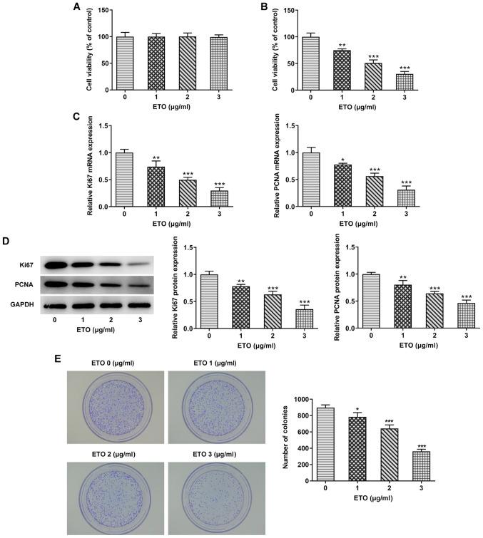 https://cdn.ncbi.nlm.nih.gov/pmc/blobs/8985/8453325/c7f5a77c04c1/etm-22-05-10689-g00.jpg