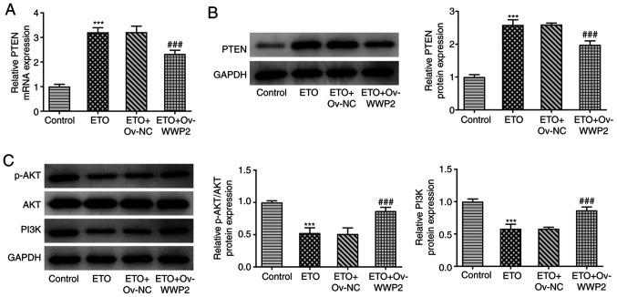 https://cdn.ncbi.nlm.nih.gov/pmc/blobs/8985/8453325/fae24510bfd6/etm-22-05-10689-g04.jpg