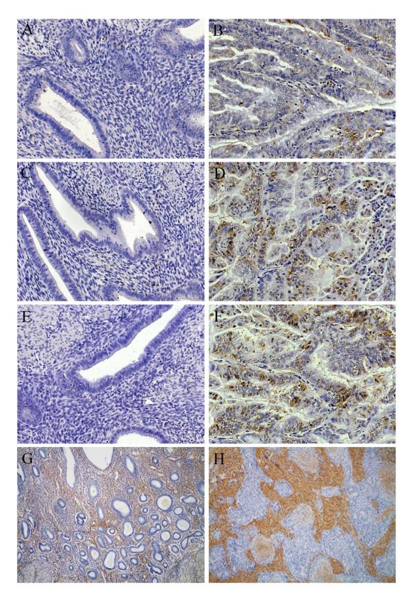 https://cdn.ncbi.nlm.nih.gov/pmc/blobs/8986/2956733/7b5a306beb38/1471-2407-10-512-3.jpg