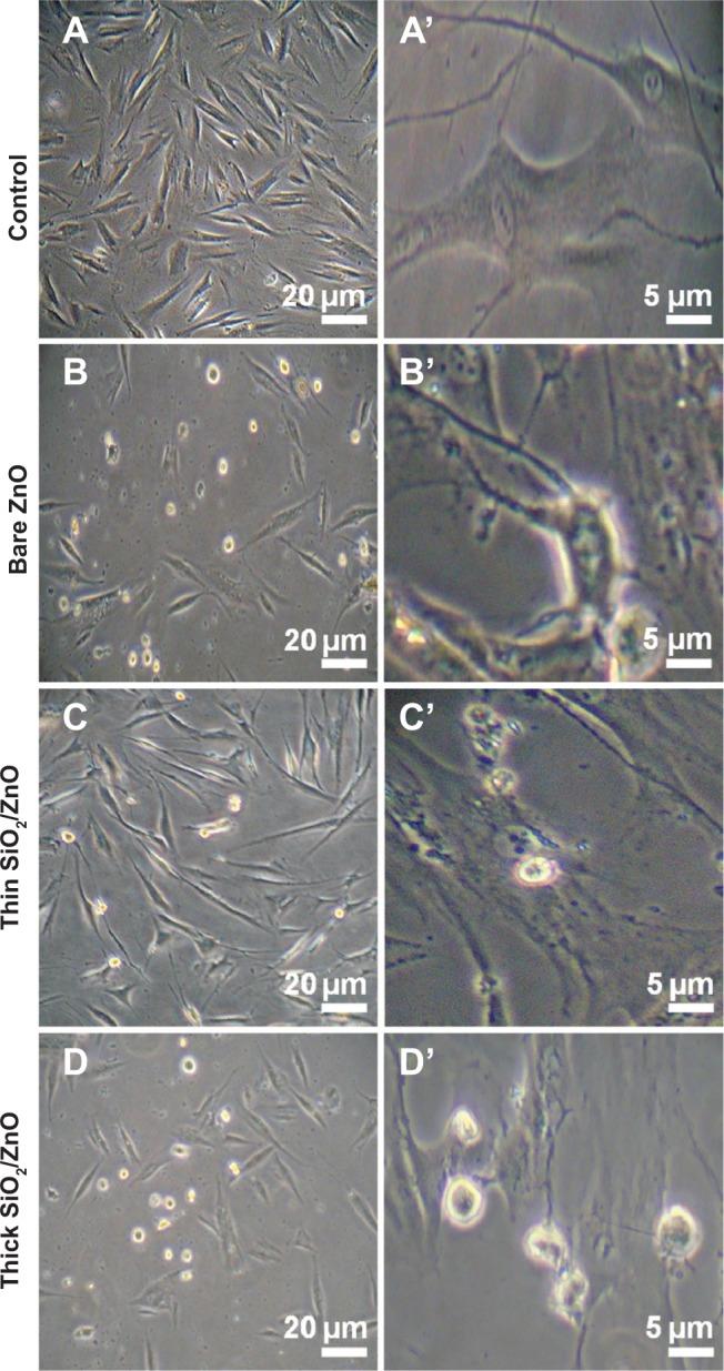https://cdn.ncbi.nlm.nih.gov/pmc/blobs/8988/4132217/69d5a104f4f8/ijn-9-3707Fig5.jpg